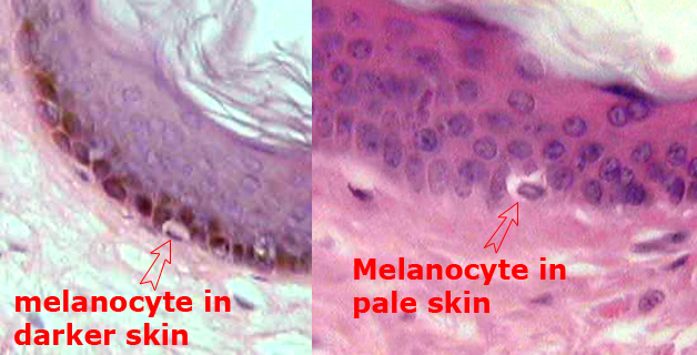 melanocyte3